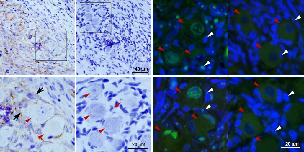 Shingles virus cells