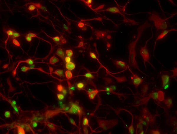 Shingles virus cells